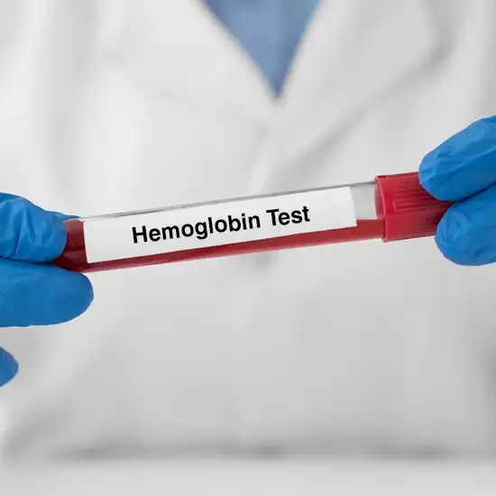 Hemoglobin Test at Home